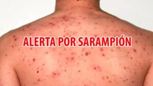 descarga